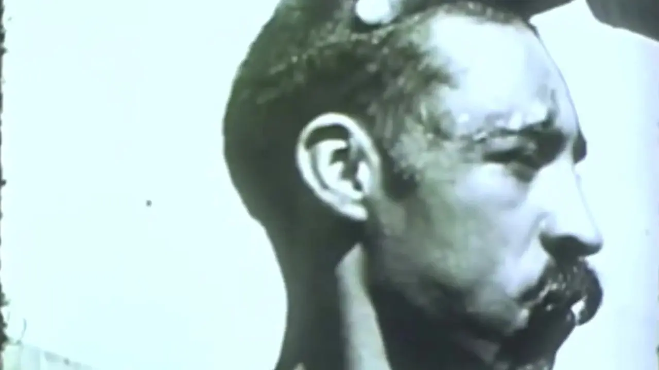 Rabies in a Human Patient backdrop