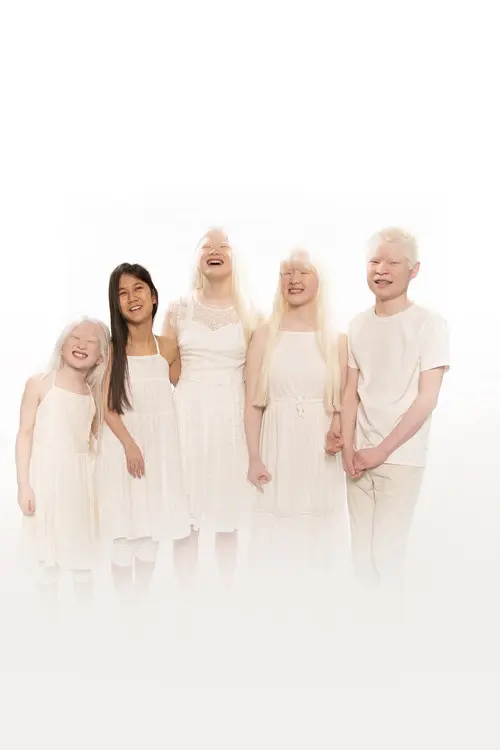Born with Albinism