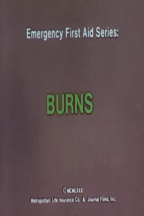 Emergency First Aid Series: Burns